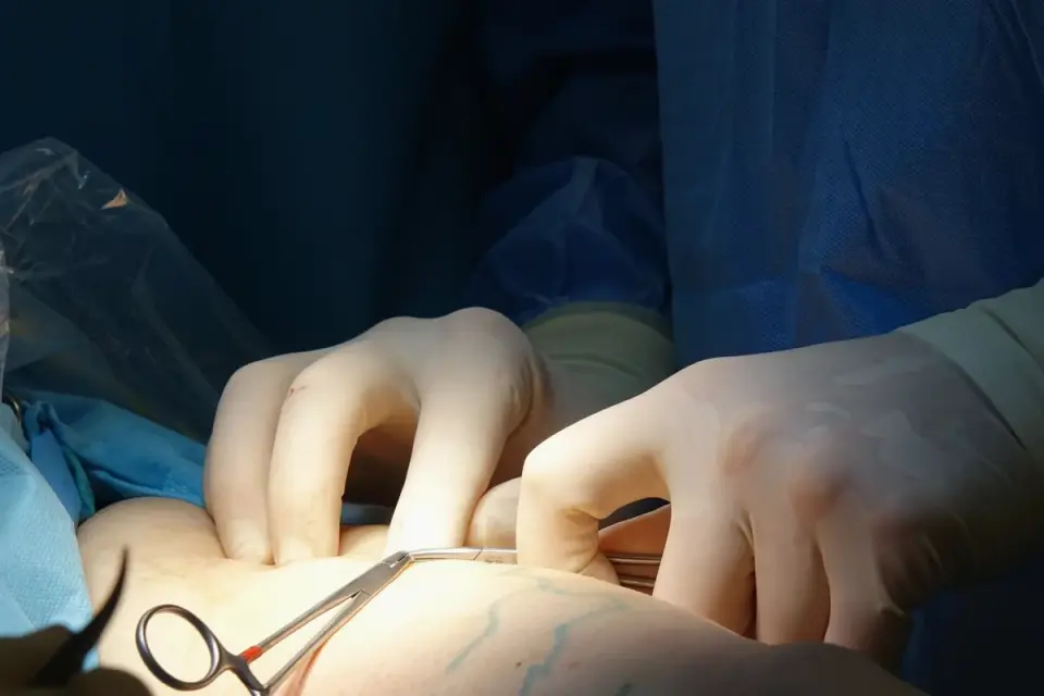 A veterinarian gently checking a dog&#x27;s abdominal incision during a follow-up exam